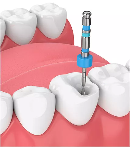 Endodontics logo